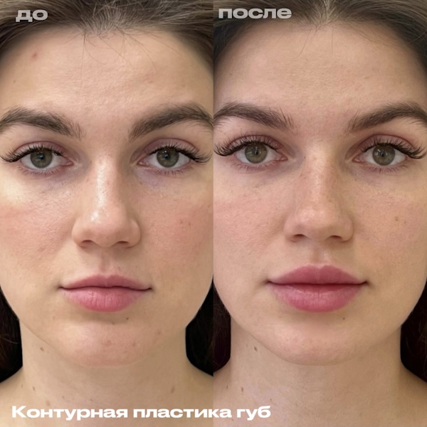 Шоно Анна Анатольевна