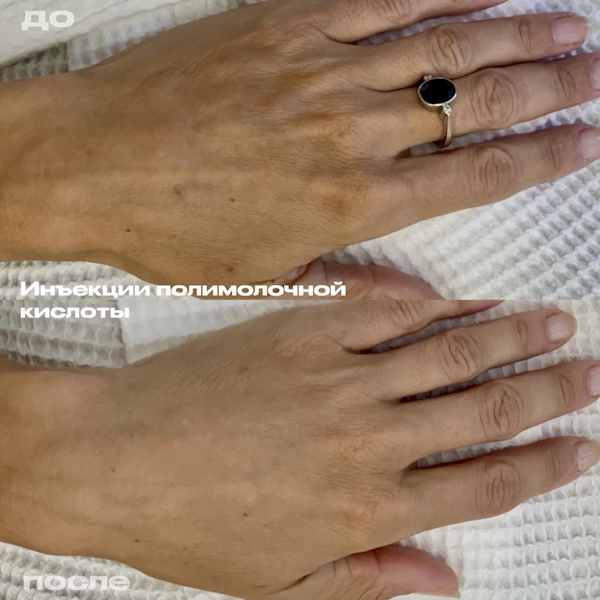 Шоно Анна Анатольевна