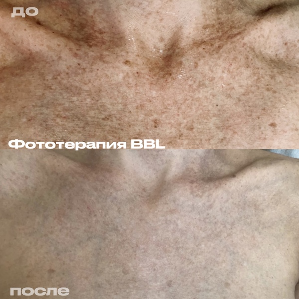 Шоно Анна Анатольевна