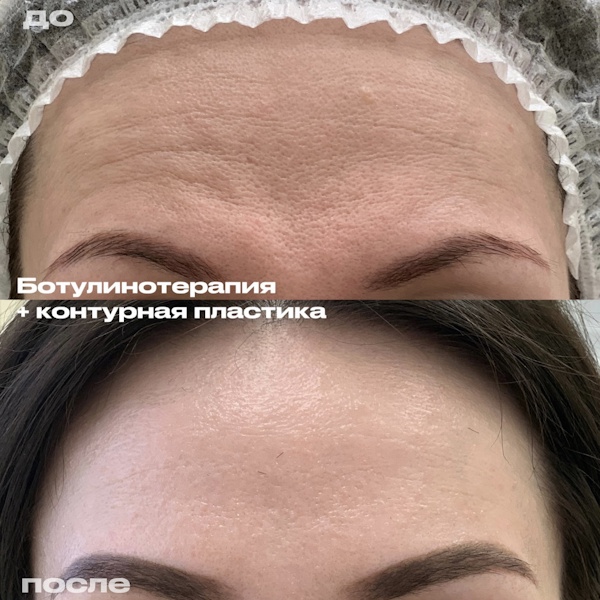 Шоно Анна Анатольевна