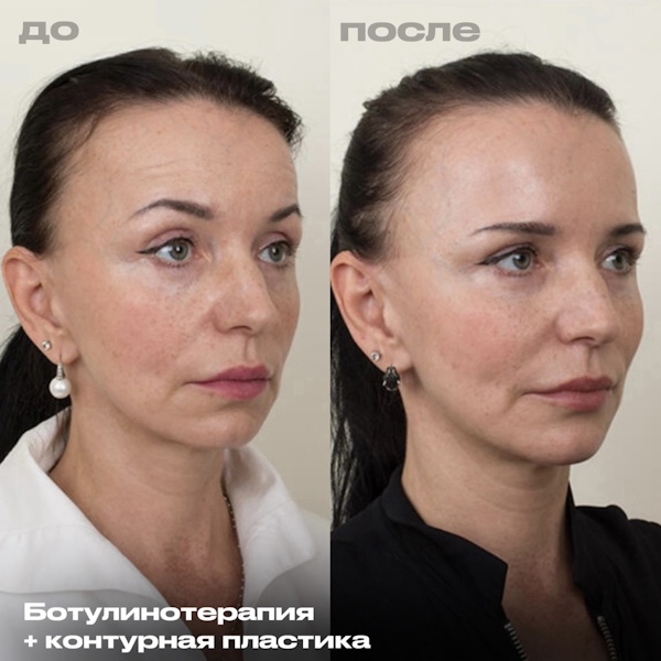 Шоно Анна Анатольевна