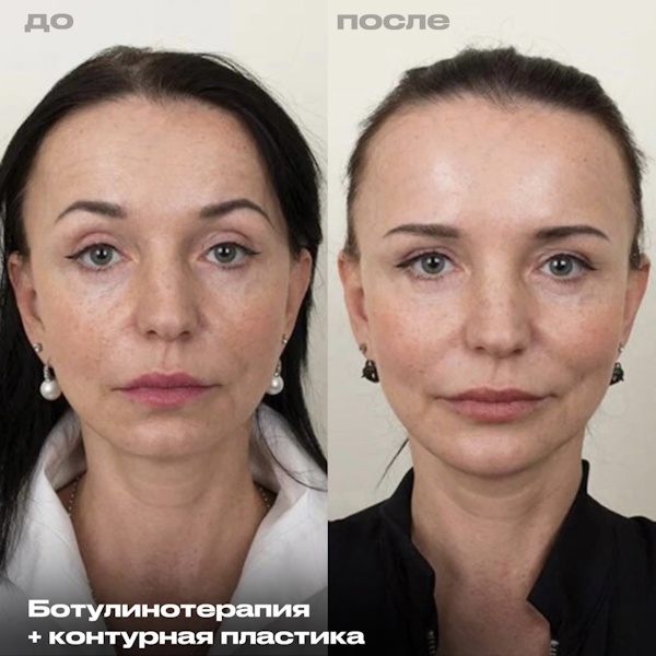 Шоно Анна Анатольевна