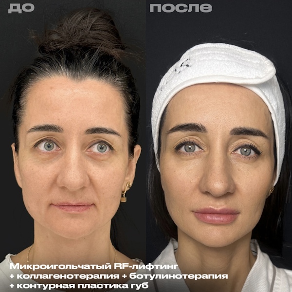 Зубенко Александра Александровна