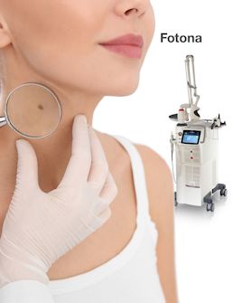 ru;Fotona: удаление новообразований