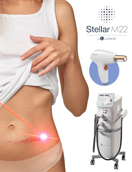 ru;Лечение рубцов ResurFX Stellar М22