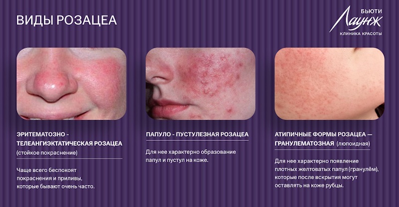 ru;Расширенная консультация врача-косметолога;ru/msk;Консультация врача-косметолога