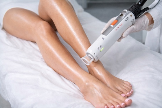 ru;Лазерная эпиляция Lutronic Clarity II