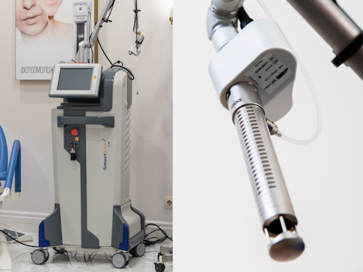 DEKA SmartXide 2
