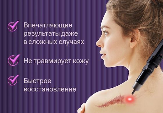 ru;Лазерное удаление рубцов, растяжек и шрамов PicoSure