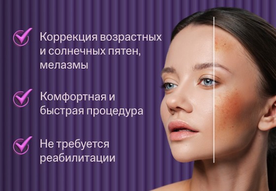 ru;Лечение пигментации Stellar M22