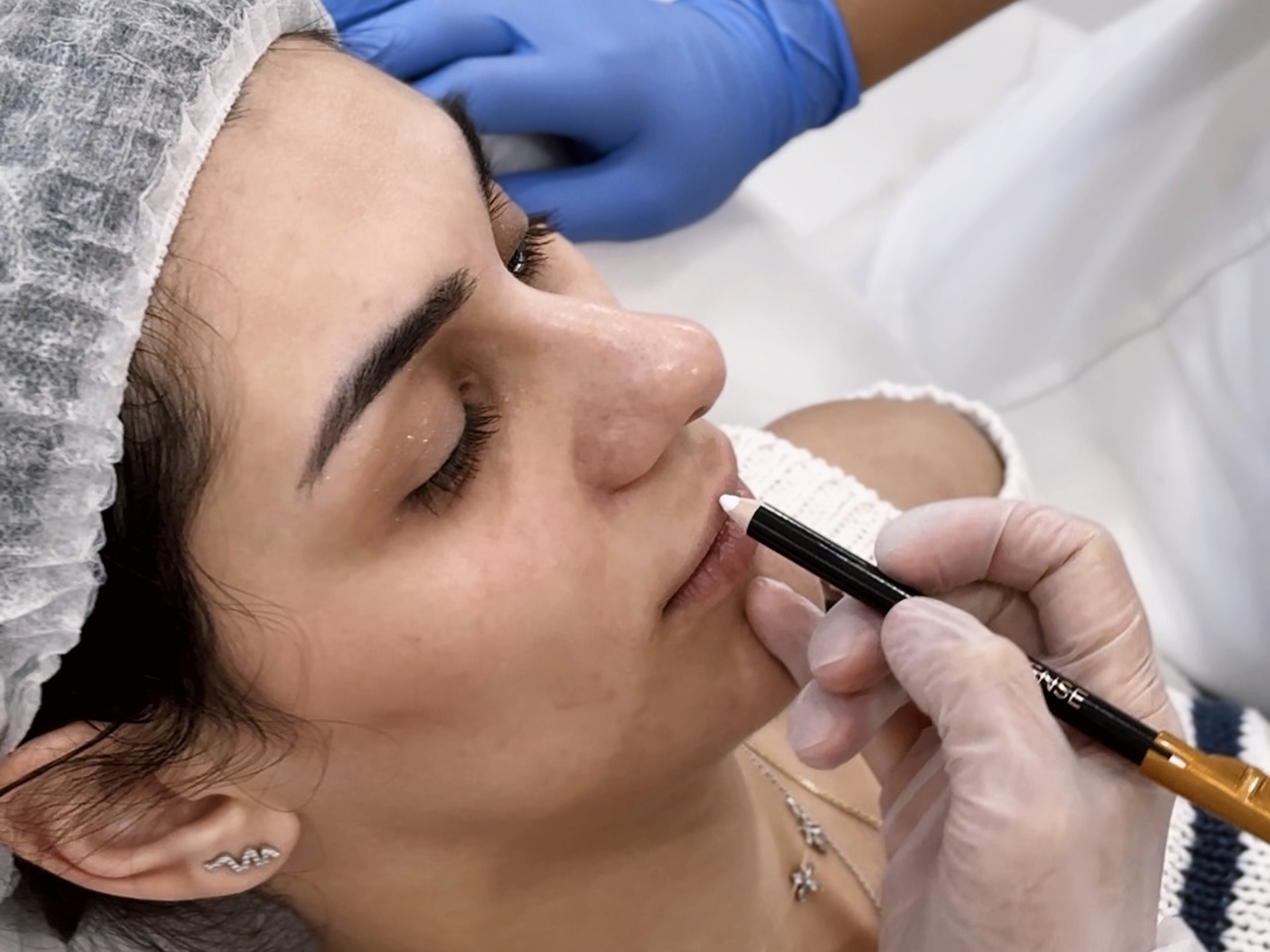 Индивидуальная постановка руки Merz Aesthetics, г. Саратов