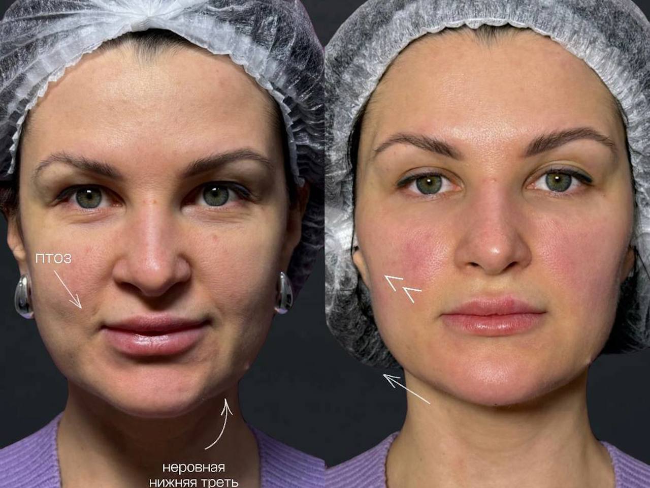 Повышаем квалификацию: наши врачи прошли обучение у тренера Merz, г. Саратов